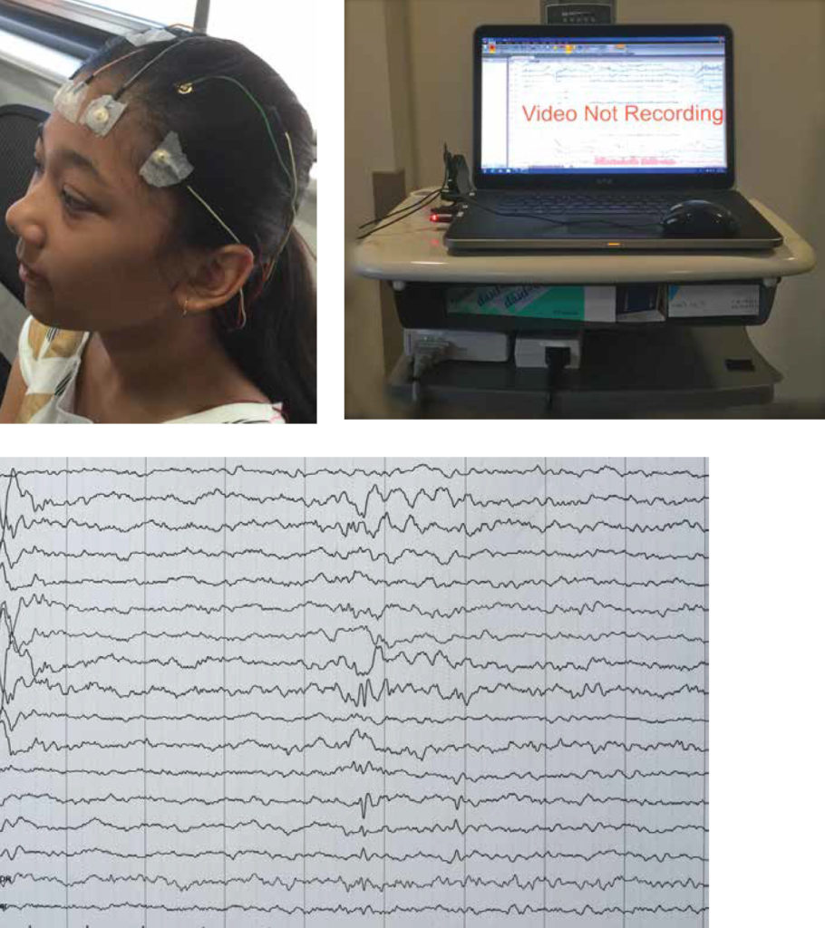 Eeg Test Time